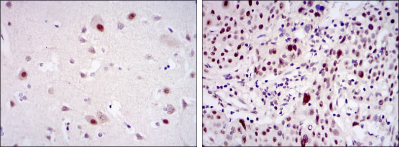 CDK9 Antibody (clone 1B5A7)