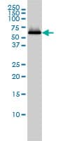 SESN2 / HI95 Antibody (clone 3B8)