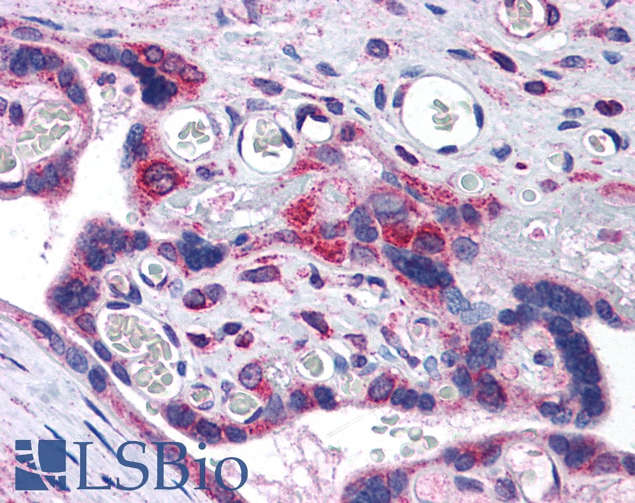 IHC-plus™ TXNDC1 / TMX1 Antibody (aa269-280)