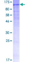 Human NEP / DDR1 Protein (Recombinant GST)