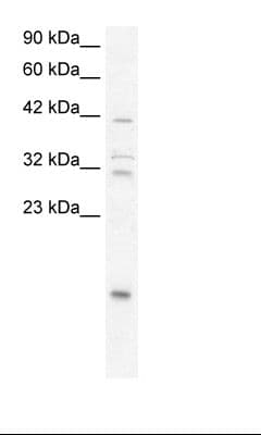 NFKBIA / IKB Alpha / IKBA Antibody (N-Terminus)