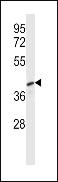 PELI3 / Pellino 3 Antibody (aa1-30)