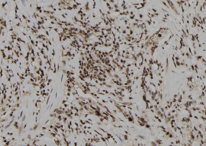 DUSP6 / MKP3 Antibody