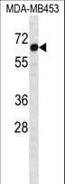 TSAP6 / STEAP3 Antibody (aa441-470)