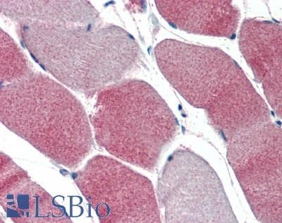LPL / Lipoprotein Lipase Antibody (aa55-316)