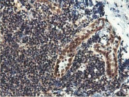 EPN2 Antibody (clone OTI1G3, Carrier-free)