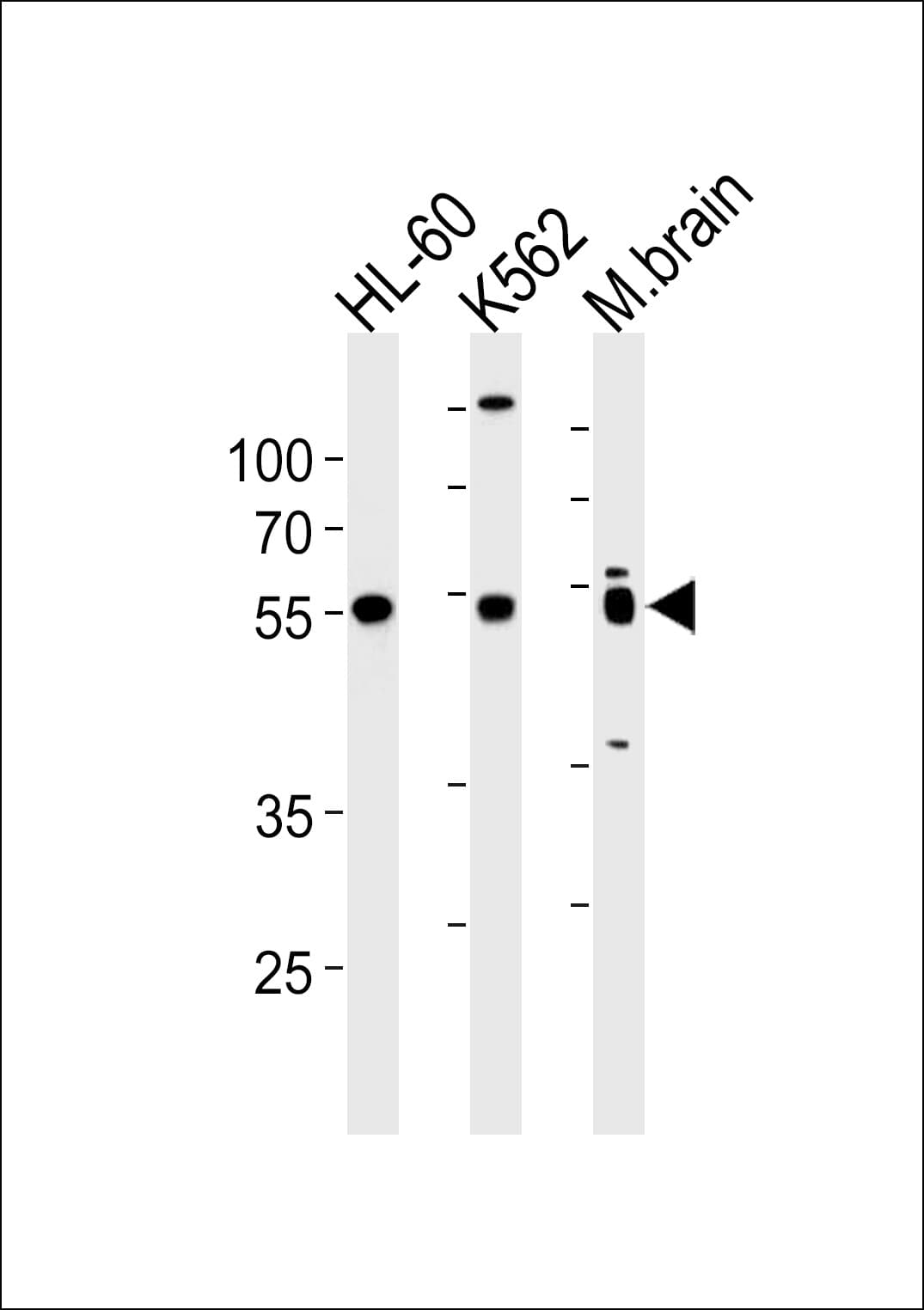 PTGER4 / EP4 Antibody (aa242-269)