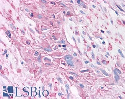 PathPlus™ GRM2 / MGLUR2 Antibody (N-Terminus)