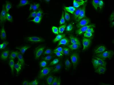 SLC26A9 Antibody
