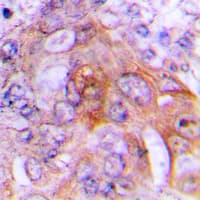 HSD17B10 / HADH2 Antibody (Internal)