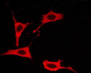 EGFR Antibody (phospho-Thr693)