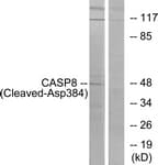 Polyclonal Rabbit anti-Human CASP8 / Caspase 8 Antibody (aa335-384, WB)