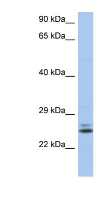 Polyclonal Rabbit anti-Human RAB15 Antibody (aa35-84, WB)