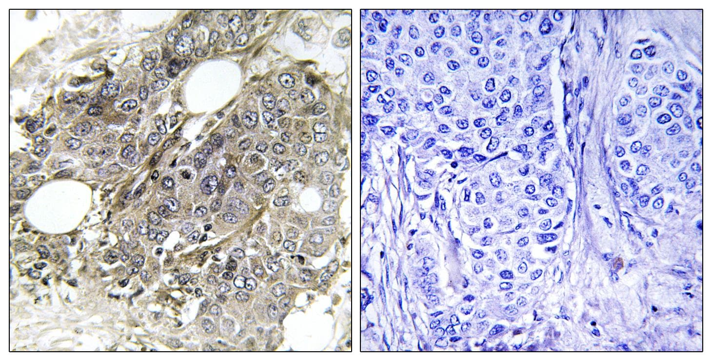 Polyclonal Rabbit anti-Human Betaglycan / TGFBR3 Antibody (IHC)