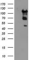 Monoclonal Mouse anti-Human MTFMT Antibody (clone OTI1E7, aa175-389, IHC, WB)