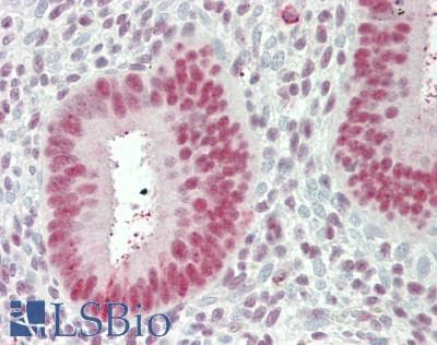 Polyclonal Rabbit anti-Human NCL / Nucleolin Antibody (aa388-569, IHC, WB)