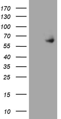 ESR2 / ER Beta Antibody (aa1-260, clone OTI3E4, Carrier-free)