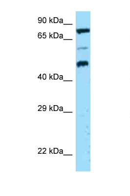 DPP4 / CD26 Antibody (aa20-69)