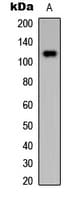 Polyclonal Rabbit anti-Human HDAC4 Antibody (Internal, WB)