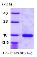 Human VEGF 121 Protein (Recombinant His)