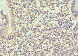Polyclonal Rabbit anti-Human BMP15 Antibody (aa143-392, IHC)