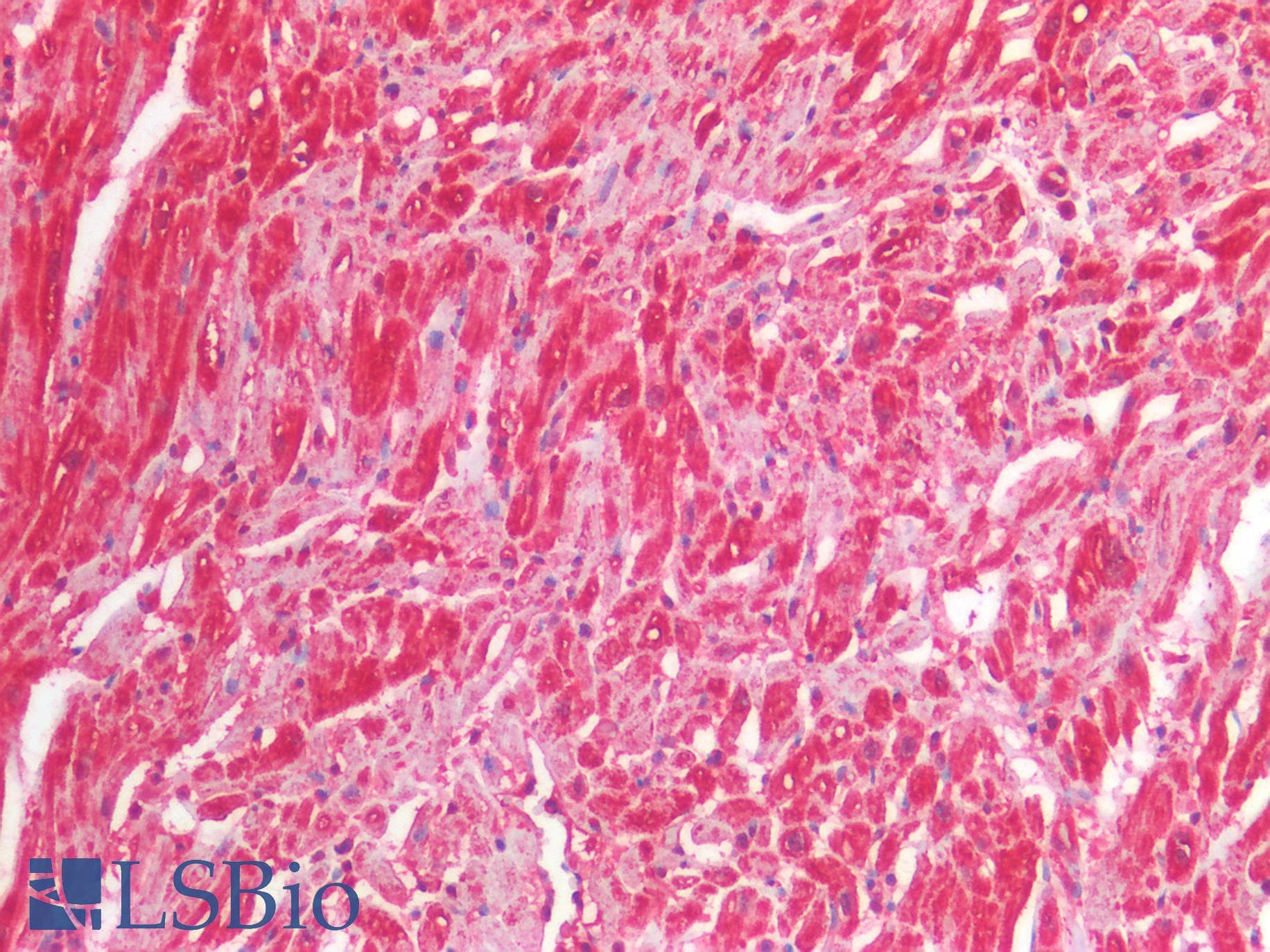 IHC-plus™ Polyclonal Rabbit anti-Human IL25 / IL17E Antibody (IHC)