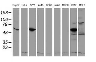 IHC-plus™ REEP2 Antibody (clone 2B7)