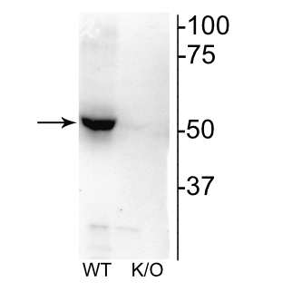 CHRNB2 Antibody