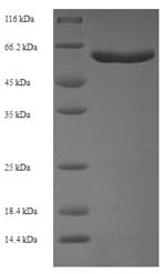 Human SOD3 Protein (Recombinant 6His, N-terminus)