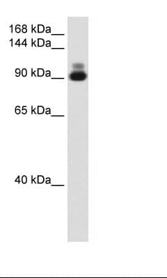 ACTN2 Antibody (C-Terminus, HRP)
