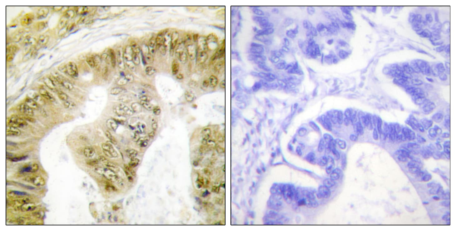 Polyclonal Rabbit anti-Human FANCA Antibody (phospho-Ser1149, IHC, IF, WB)