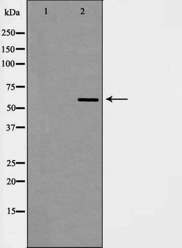 HNRNPL / hnRNP L Antibody