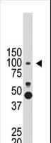 PROX1 Antibody (aa144-175)