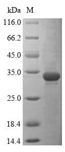 Mouse DOCK8 Protein (Recombinant 6His, N-terminus)
