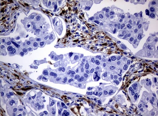 TP / Thymidine Phosphorylase Antibody (aa311-482, clone UMAB98)