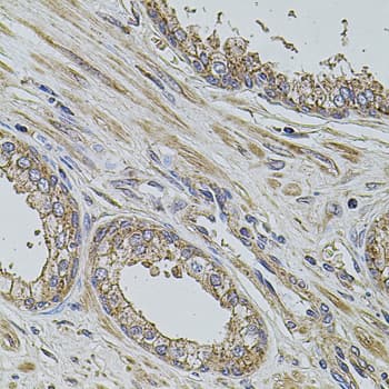 PDCD6IP / ALIX Antibody