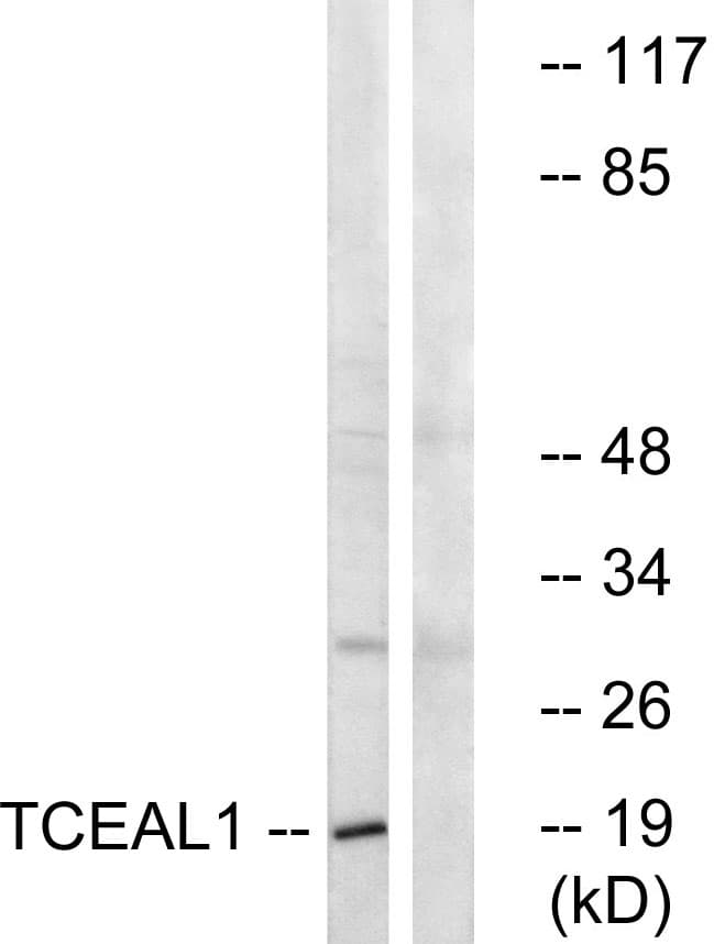 Polyclonal Rabbit anti-Human TCEAL1 Antibody (aa91-140, WB)
