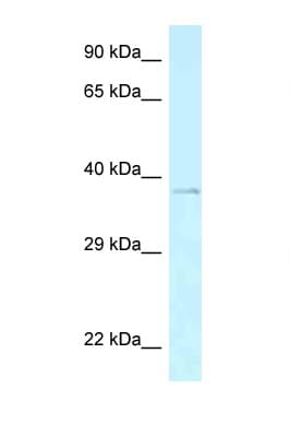 AEBP2 Antibody (C-Terminus)