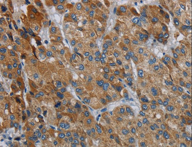 PDSS2 / DLP1 Antibody