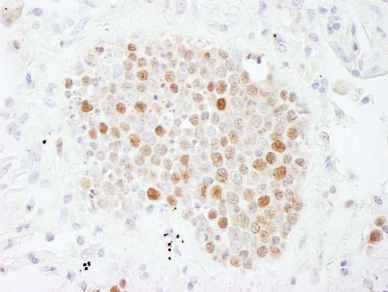 Polyclonal Rabbit anti-Human CHAF1B / CAF1 Antibody (aa509-C-term, IHC, WB)