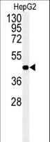 Polyclonal Rabbit anti-Human NR5A1 / SF1 Antibody (aa64-93, IHC, WB)