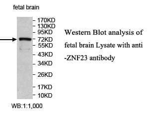 ZNF23 Antibody (aa172-436)