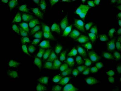 Polyclonal Rabbit anti-Human BICD2 Antibody (IHC, IF, WB)