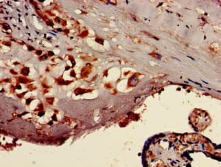 Polyclonal Rabbit anti-Human TTC27 Antibody (IHC, WB)