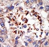 Polyclonal Rabbit anti-Human CBX8 Antibody (aa306-337, IHC, WB)