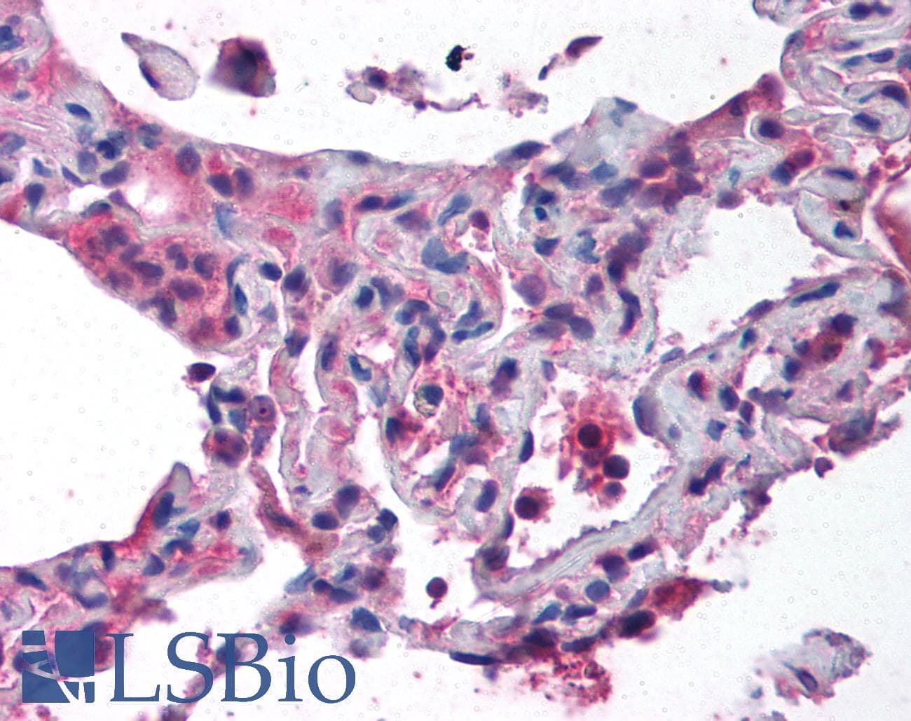Polyclonal Rabbit anti-Human CTCF Antibody (N-Terminus, IHC, WB)