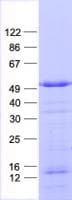 Human FOS / c-FOS Protein (Recombinant His, N-Terminal)