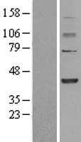 FBXO28 Protein (Over-Expression Lysate Myc-DDK (Flag))