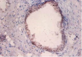 PKMYT1 Antibody