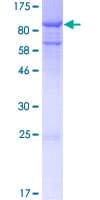 Human OFD1 Protein (Recombinant GST)
